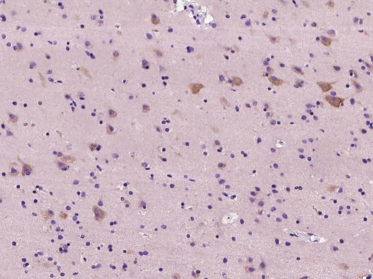 NRP1 / Neuropilin 1 Antibody