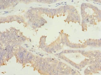 EIF2B1 Antibody