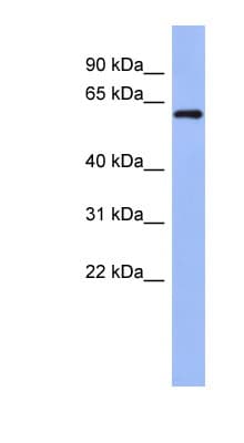 RBM47 Antibody (aa287-336)