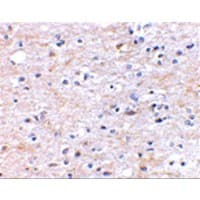 Polyclonal Rabbit anti-Human TOCA1 / FNBP1L Antibody (IHC, IF, WB)