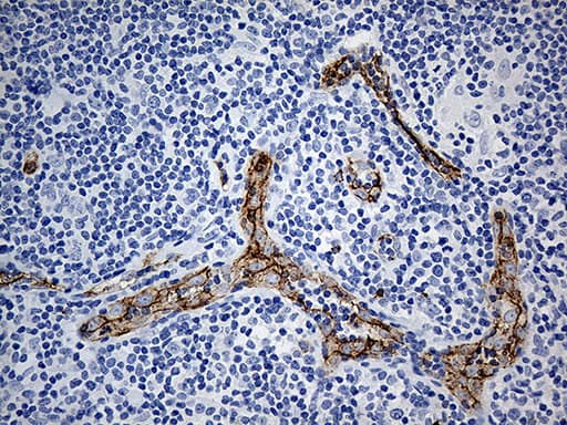 Monoclonal Mouse anti-Human CD34 Antibody (clone OTI8F11, Carrier-free, aa312-385, IHC, WB)