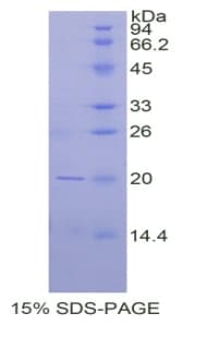 Mouse CD247 / CD3 Zeta Protein (Recombinant His, N-Terminal)