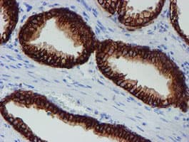 SRPRB Antibody (clone OTI1D9)