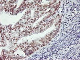 Monoclonal Mouse anti-Human RNF113B Antibody (clone OTI7A1, IHC, IF, WB)