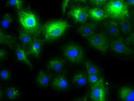 KRT8 / CK8 / Cytokeratin 8 Antibody (clone OTI1B12)