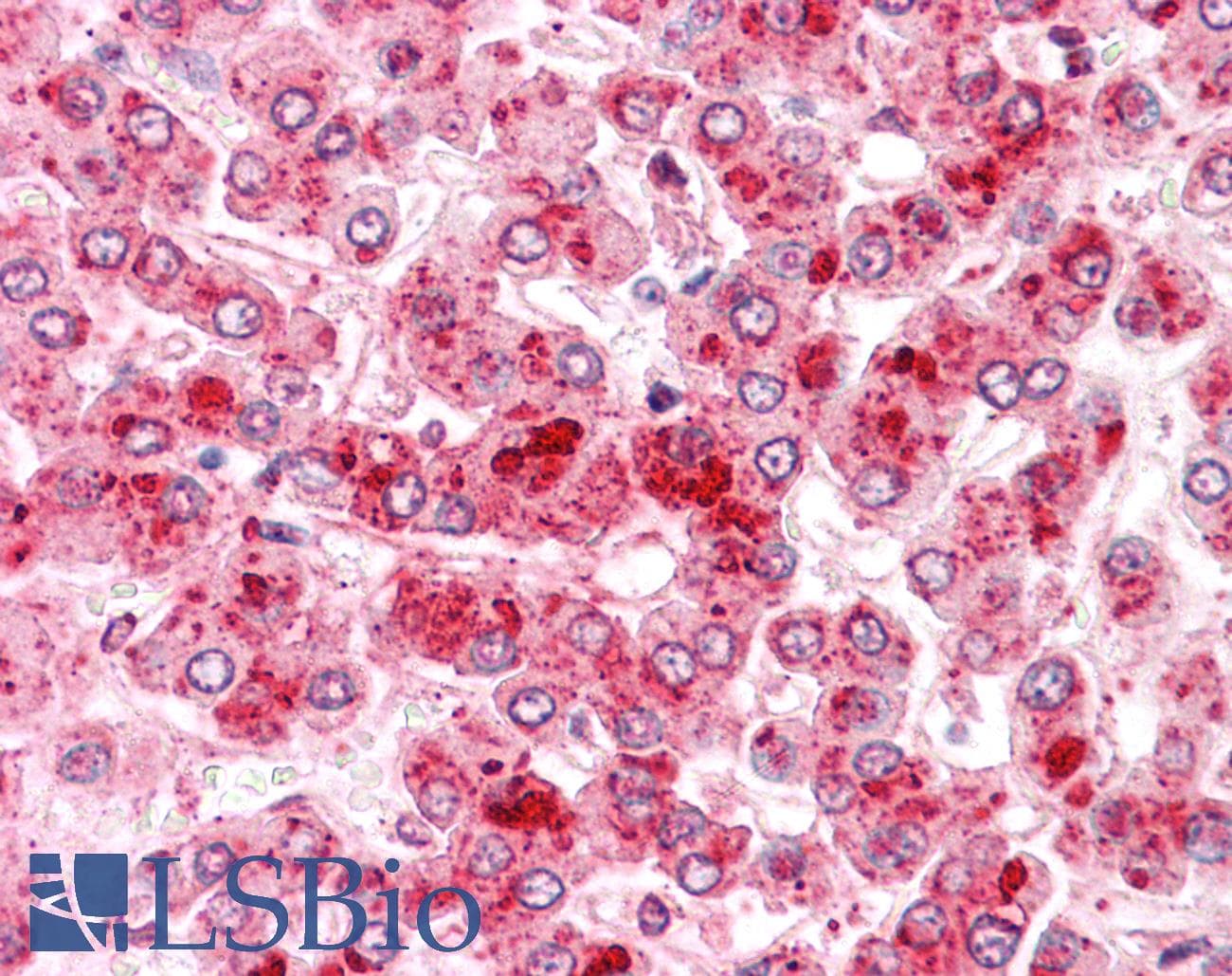 IHC-plus™ COMT Antibody (N-Terminus)