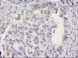 MRPS2 Antibody (clone OTI4D6)