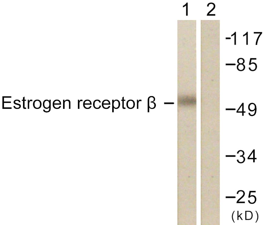 Polyclonal Rabbit anti-Human ESR2 / ER Beta Antibody (aa71-120, IF, WB)