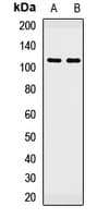 Polyclonal Rabbit anti-Human PBXIP1 / HPIP Antibody (WB)