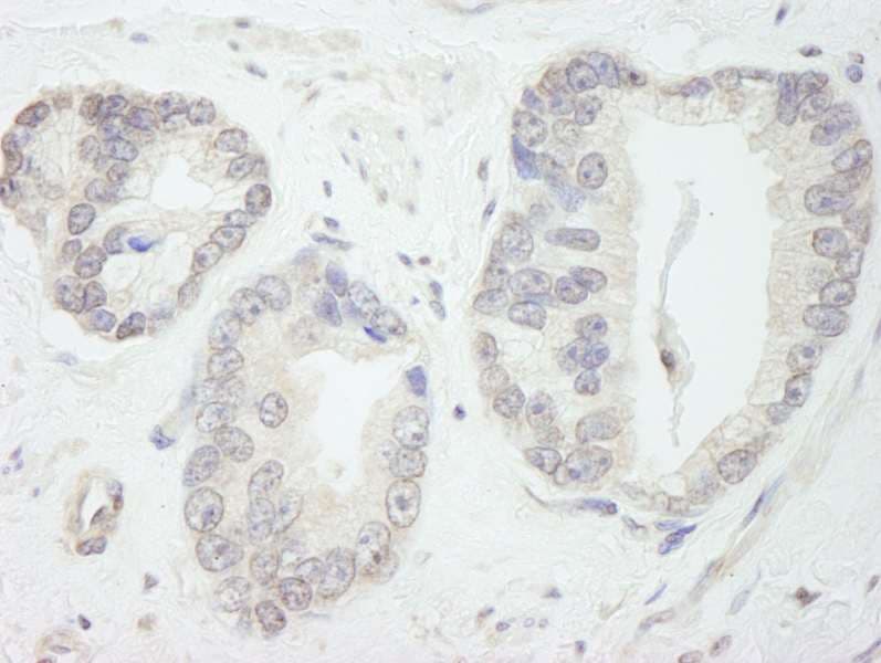GTF3C1 Antibody (aa1475-1525)