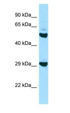 HLA-DOB Antibody (N-Terminus)