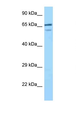 Villin-Like / VILL Antibody (C-Terminus)