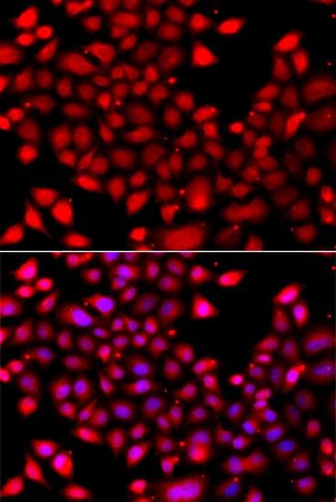 RARG / RAR-Gamma Antibody
