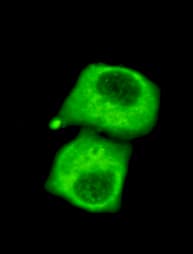 PathPlus™ PDH / Pyruvate Dehydrogenase Antibody (C-Terminus)