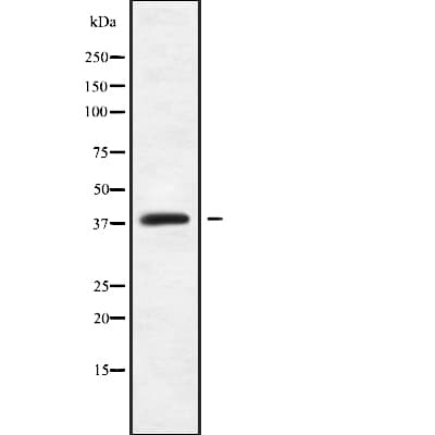 Polyclonal Rabbit anti-Human MAGEB18 Antibody (WB)
