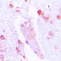 CA1 / Carbonic Anhydrase I Antibody (Internal)