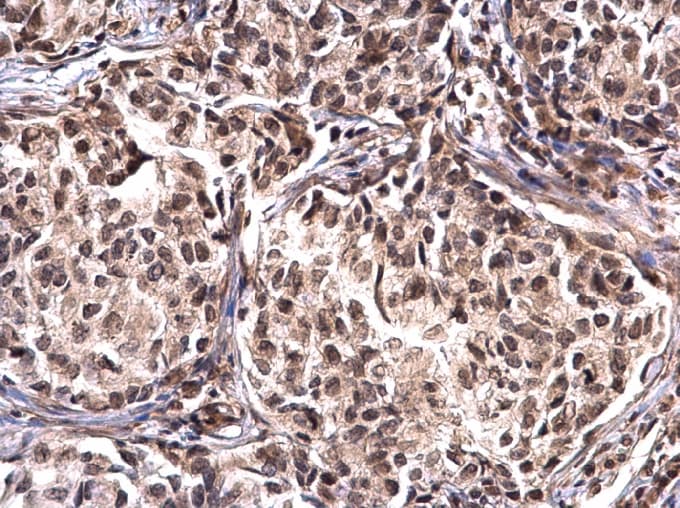 Polyclonal Rabbit anti-Human NPM1 / NPM / Nucleophosmin Antibody (aa1-209, IHC, IF)