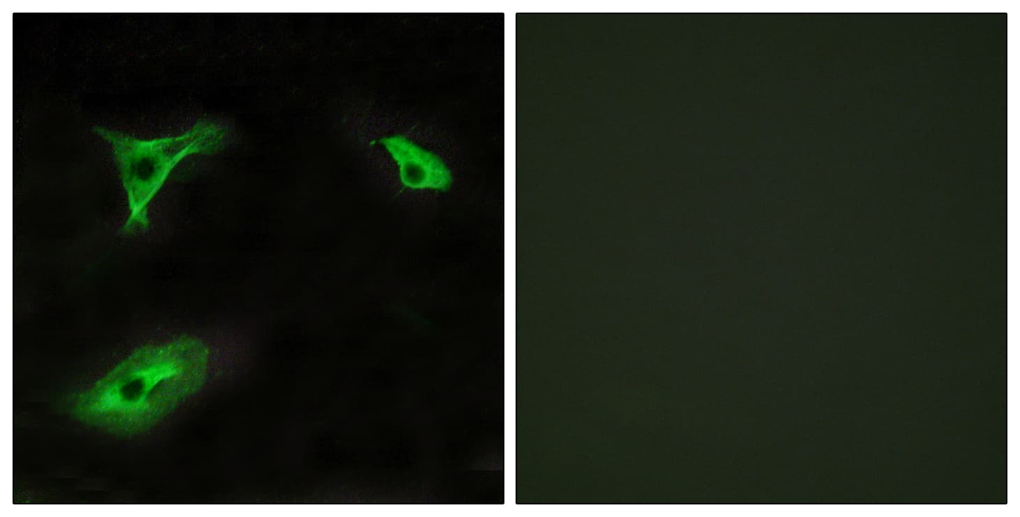 IHC-plus™ Polyclonal Rabbit anti-Human ADGRF5 / GPR116 Antibody (aa11-60, IHC, IF, WB)