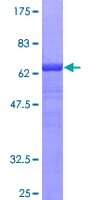 Human Alpha-1-Antichymotrypsin Protein (Recombinant GST)