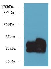 CMBL Antibody