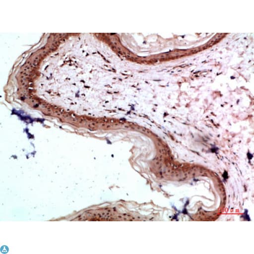 COL17A1 / Collagen XVII Antibody