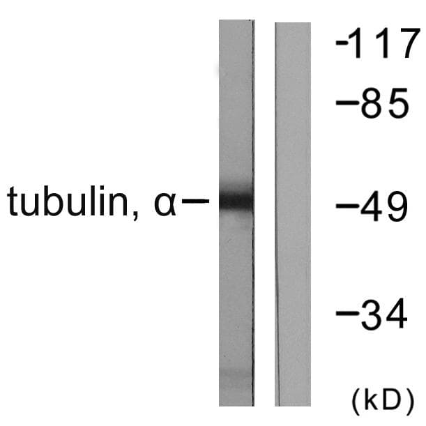 Polyclonal Rabbit anti-Human Alpha Tubulin Antibody (IHC, IF, WB)