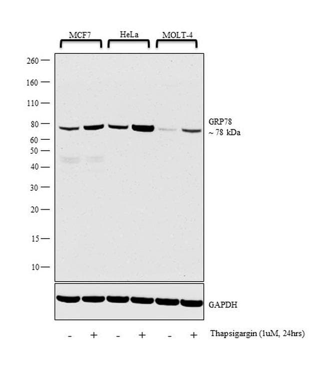 Monoclonal Mouse anti-Human HSPA5 / GRP78 / BiP Antibody (clone 4000, IHC, WB)