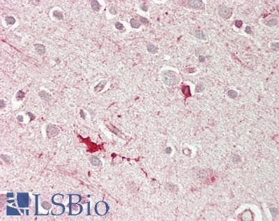 IHC-plus™ Polyclonal Rabbit anti-Human Heparanase 2 / HPSE2 Antibody (IHC, WB)