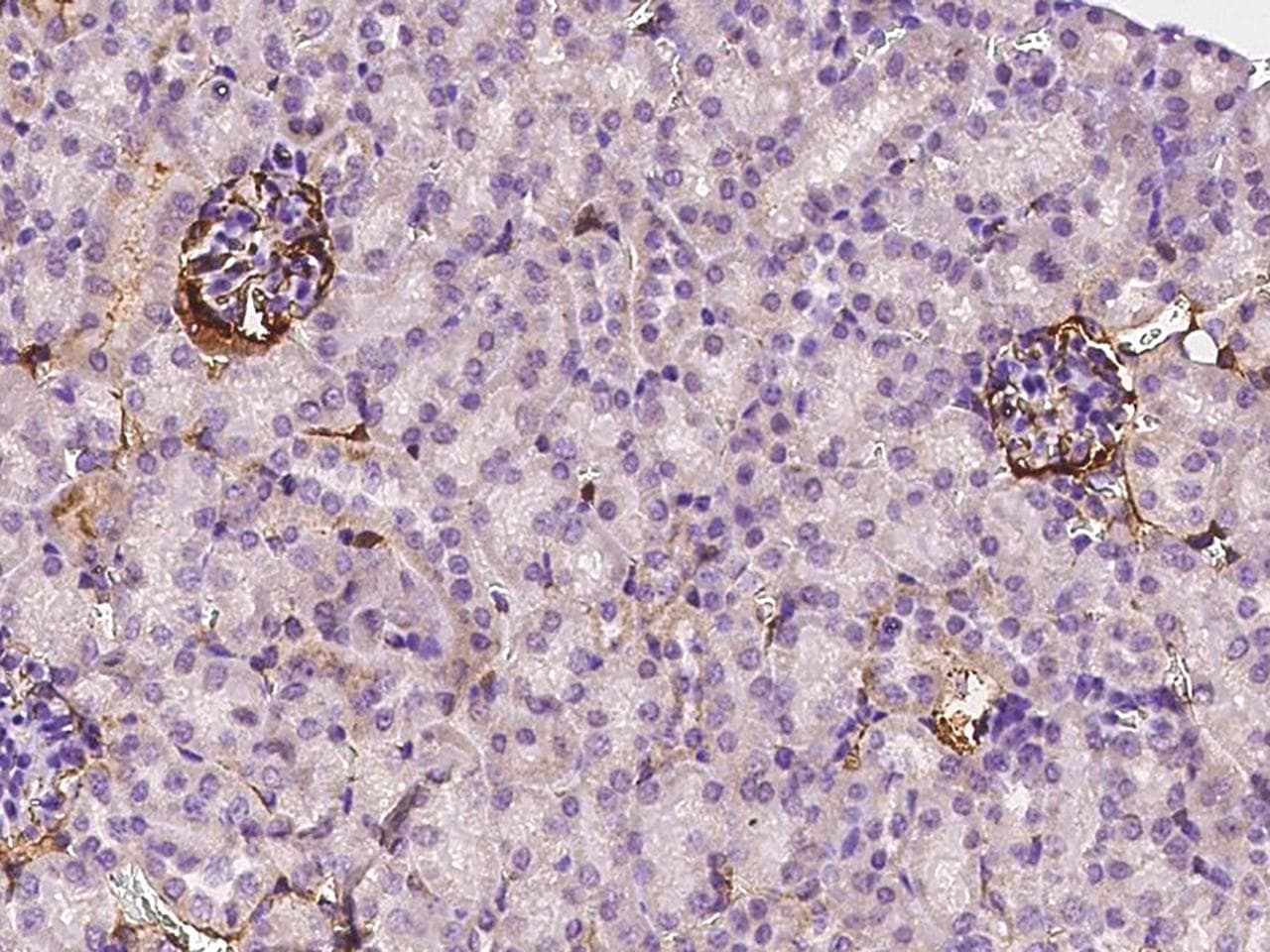 BST2 Antibody