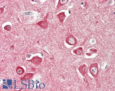 IHC-plus™ SLC12A6 / KCC3 Antibody (aa25-75)