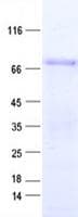 Human ZNF317 Protein (Recombinant His, N-Terminal)