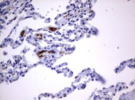 CD30 Antibody (clone OTI18D3)