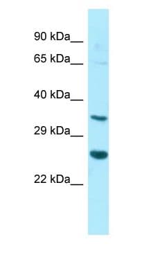 HT036 / HYI Antibody (aa55-104)