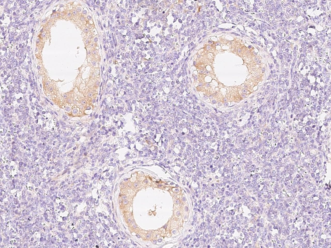 PIK3R2 / p85 Beta Antibody (Preservative Free)