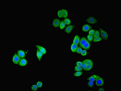 Polyclonal Rabbit anti-Human SSTR2 Antibody (IHC, IF, WB)