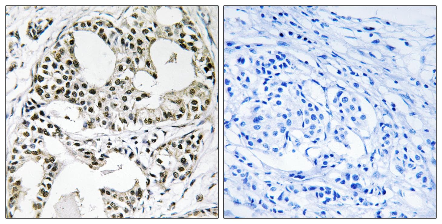 YEATS2 Antibody