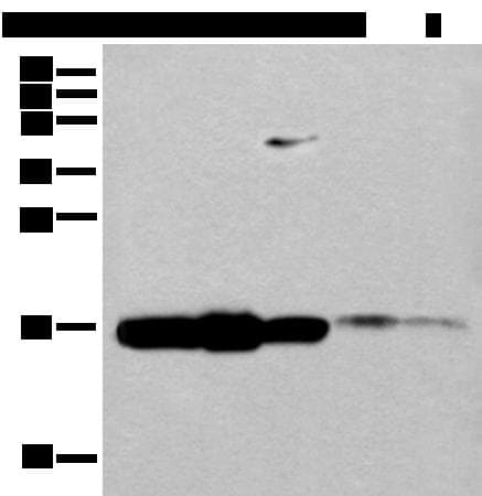 UEV1 / UEV1A Antibody