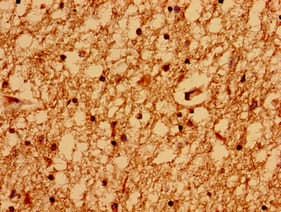 GRIN2A / NMDAR2A / NR2A Antibody (aa501-750)