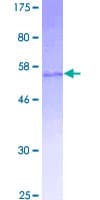 Human SNAI2 / SLUG Protein (Recombinant GST)