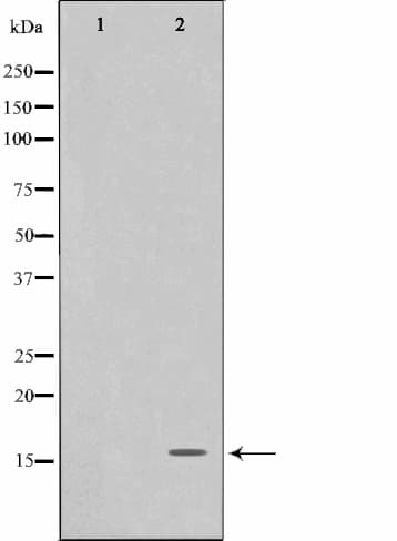 FHIT Antibody