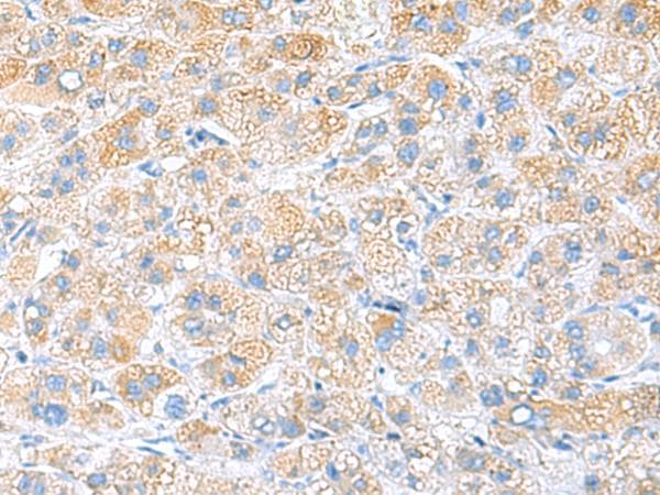 RPS16 / Ribosomal Protein S16 Antibody