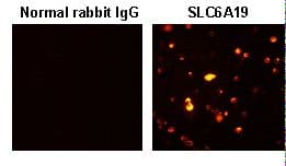 IHC-plus™ SLC6A19 Antibody