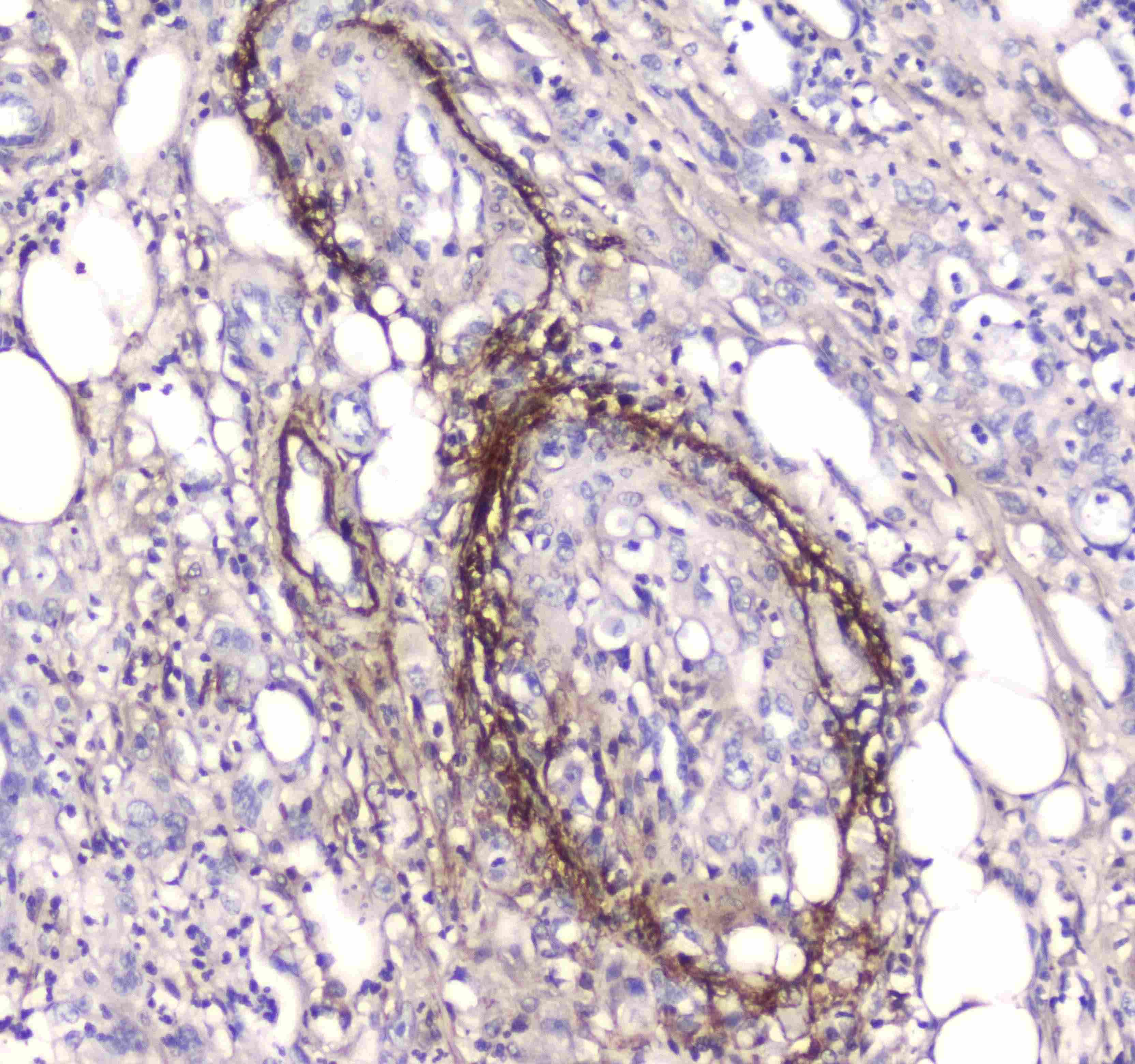 Polyclonal Rabbit anti-Human APCS / Serum Amyloid P / SAP Antibody (IHC, WB)