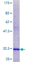 Human SPINK7 / ECRG2 Protein (Recombinant GST)
