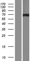 ACIN1 / Acinus Protein (Over-Expression Lysate Myc-DDK (Flag))
