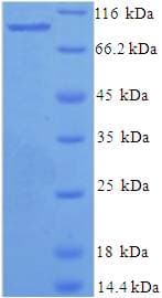 Human XPNPEP1 / Aminopeptidase P Protein (Recombinant His-SUMO)