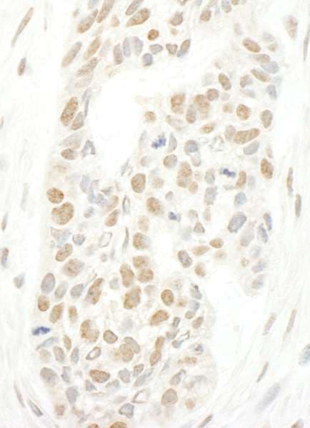 Polyclonal Rabbit anti-Human NCAPH2 / CAP-H2 Antibody (aa425-475, IHC)