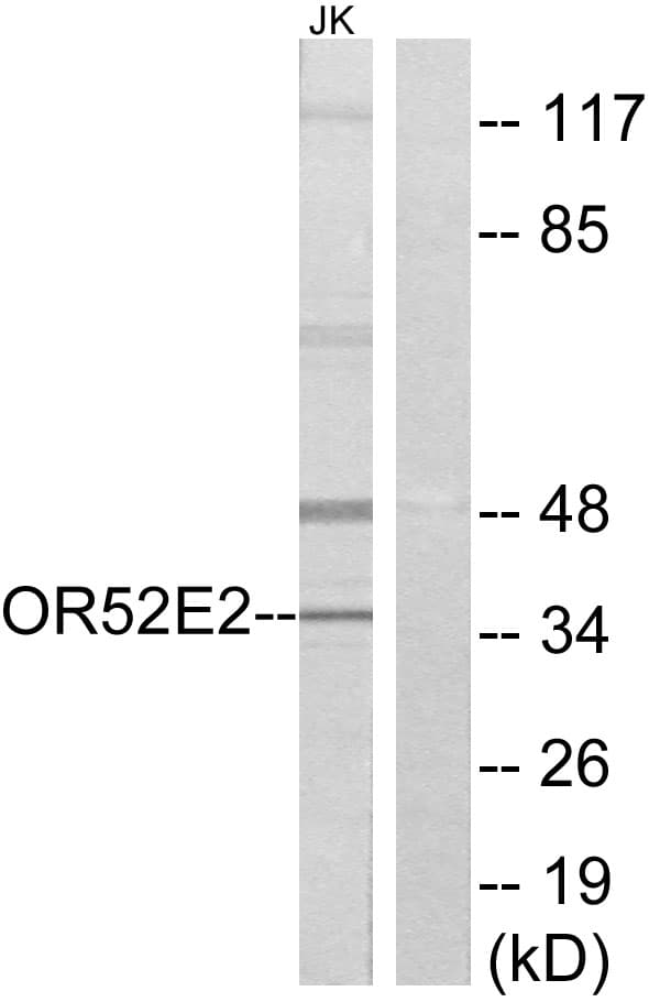 OR52E2 Antibody (aa276-325)