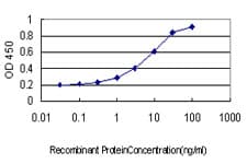PathPlus™ Monoclonal Mouse anti-Human CORO1A / Coronin 1a Antibody (clone 4G10, IHC, WB)