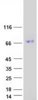 Human ENTPD8 Protein (Recombinant Myc-DDK (Flag))